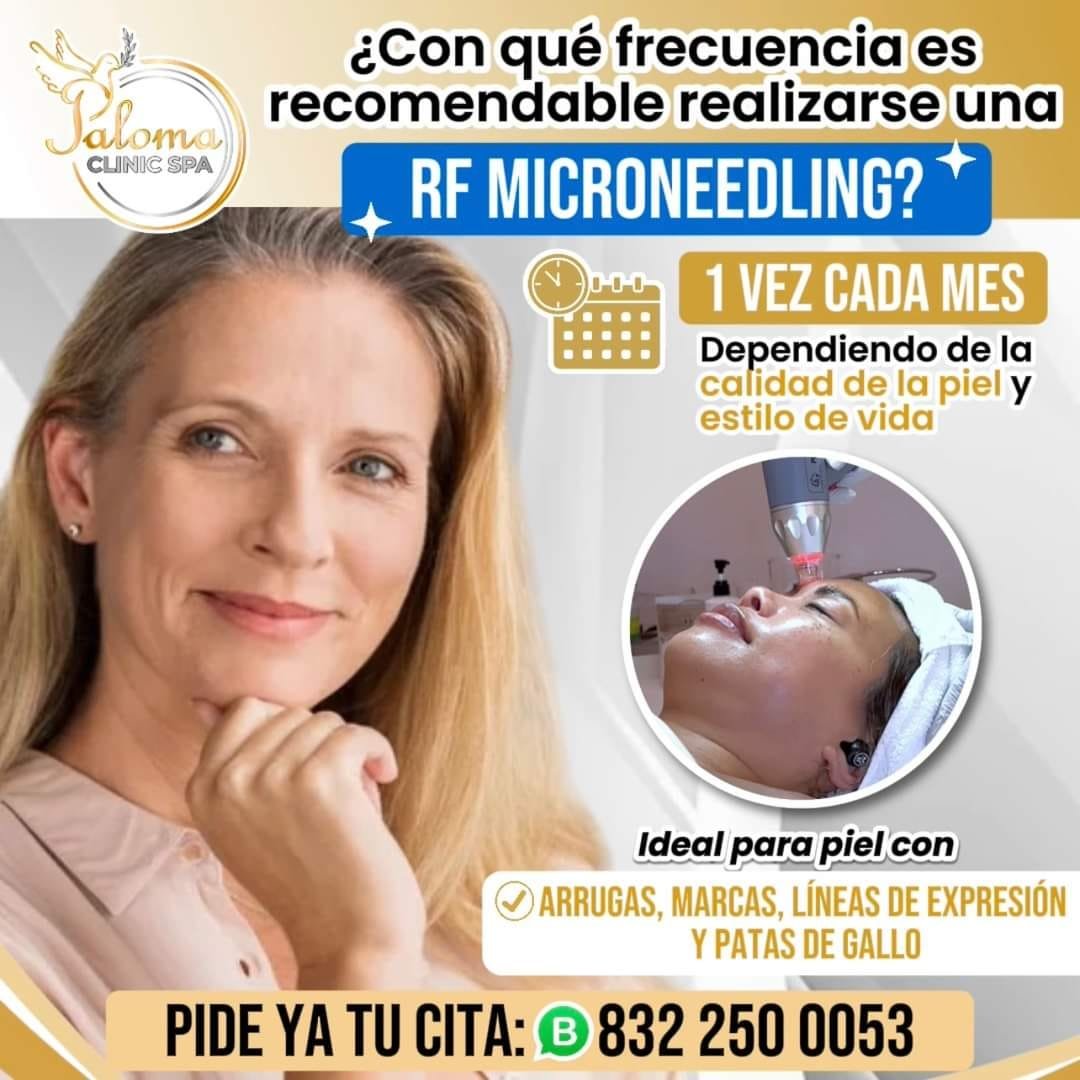 Microneedling en rostro femenino para mejorar la textura de la piel en Paloma Clinic Spa