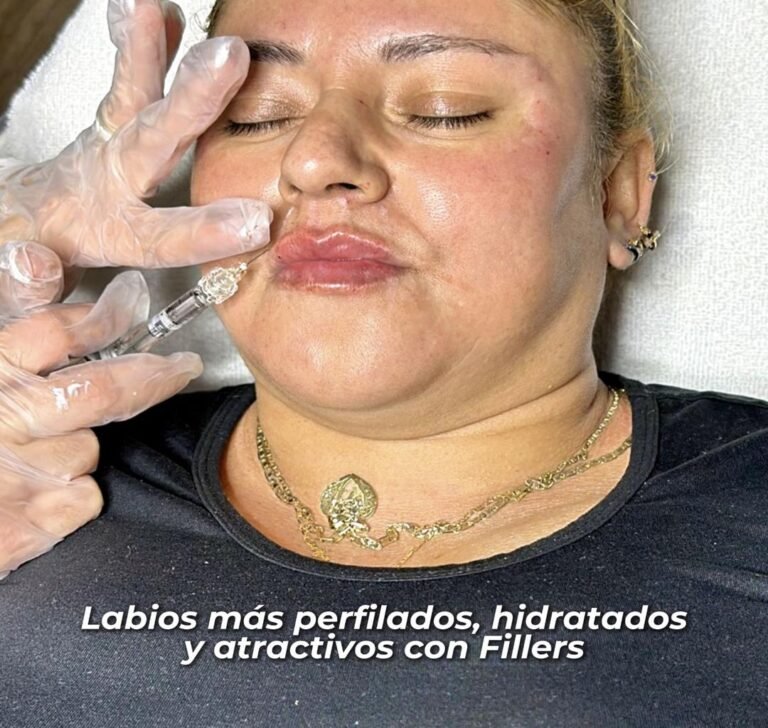 Relleno para suavizar líneas de expresión