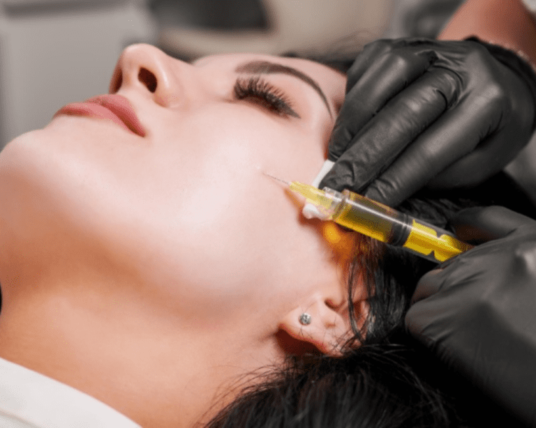 PRP Facial