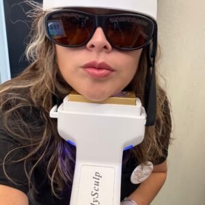 Tratamiento de radiofrecuencia para reducir papada en Houston sin cirugía