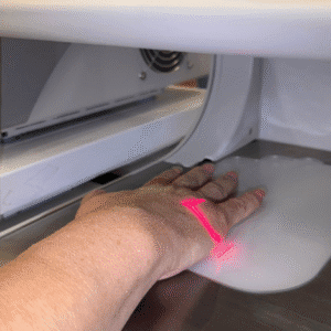 Manos rejuvenecidas después de tratamiento con láser CO2 en clínica estética de Houston